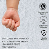 Waterproof Terry Towel Mattress Protector โ Soft, Breathable & Anti-Allergy | 30cm (12 Inch) Deep Skirt - 4A's Global